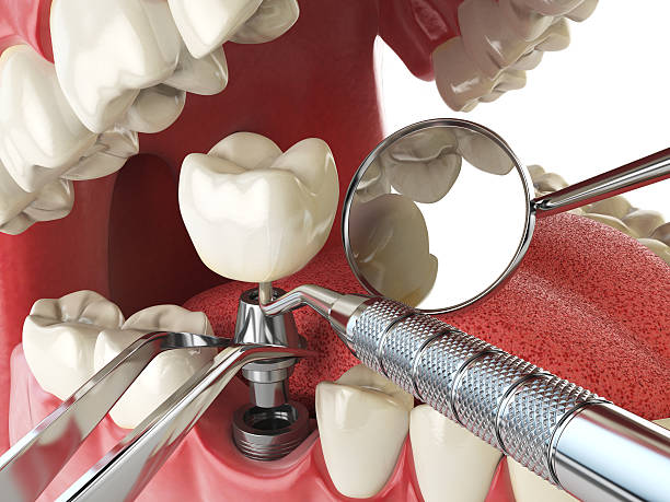 Best Orthodontic Emergency Dentist in Panthersville, GA